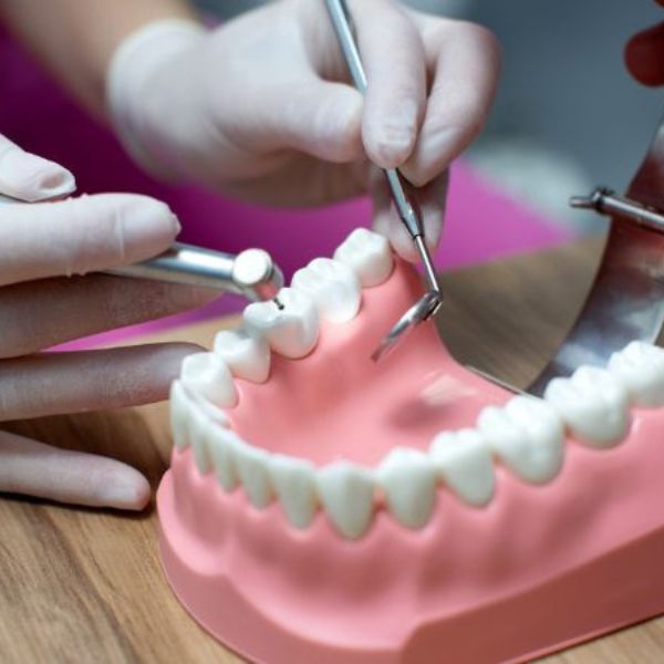 סתימות בשיניים במרפאת שיניים דר אלכסנדר