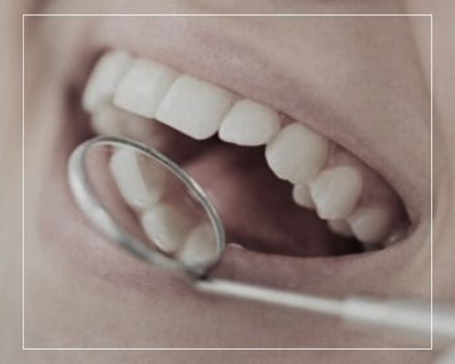 אסתטיקה דנטלית - מרפאת שיניים דר אלכסנדר