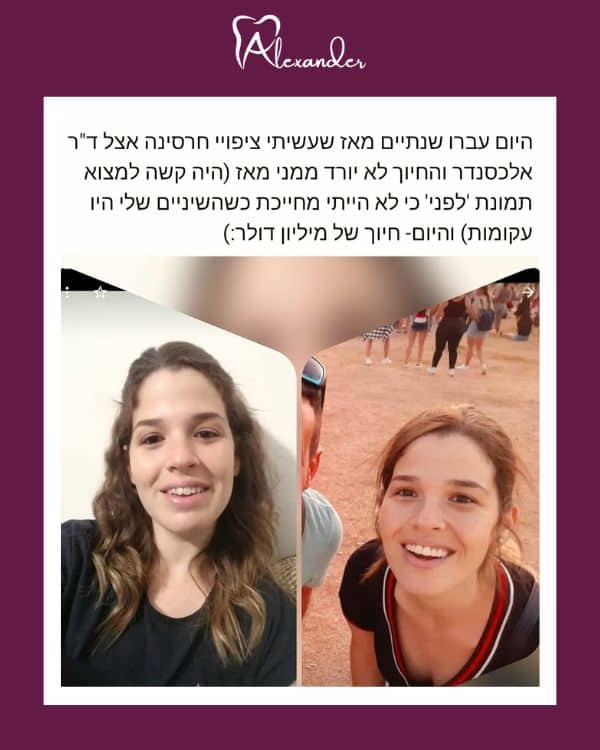 המלצות - מרפאת שיניים דר אלכסנדר