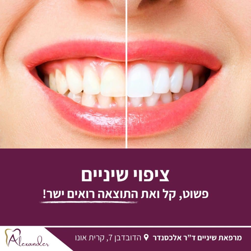 באלו מצבים דנטליים מומלץ להשתמש בציפוי שיניים מזירקוניה - דר אלכסנדר