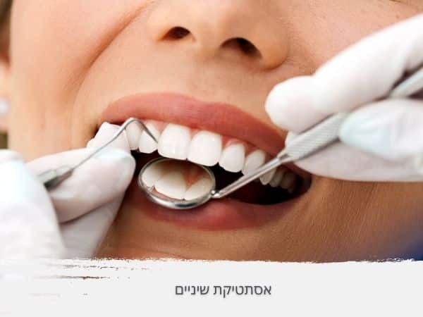 אסתטיקת שיניים - ד"ר אלכסנדר