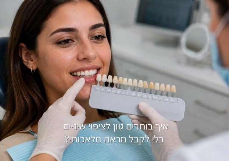 איך בוחרים גוון לציפוי שיניים בלי לקבל מראה מלאכותי - מאמר ד"ר אלכסנדר