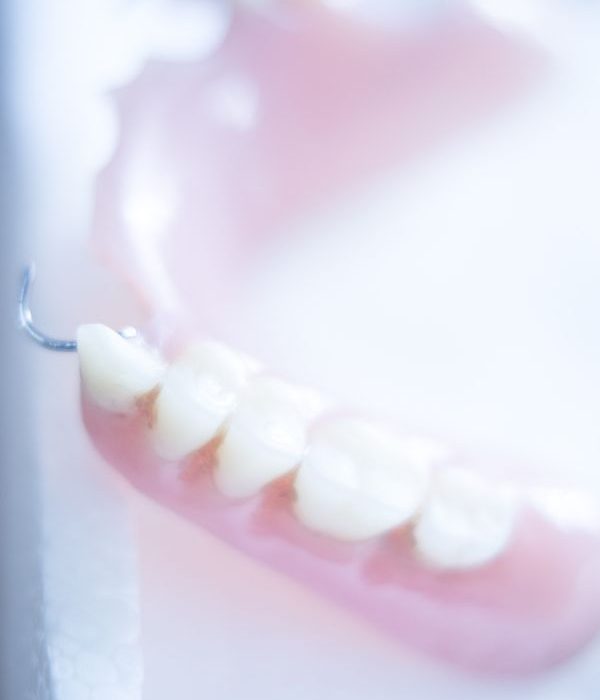 Частичные зубные протезы - Д-р Александр