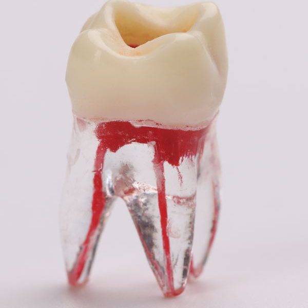 קצת על מבנה השן - מרפאת שיניים דר אלכסנדר